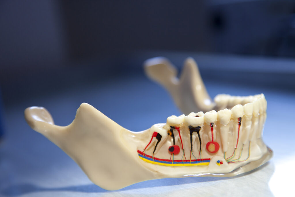 علائم درمان ناموفق عصب کشی دندان چیست؟