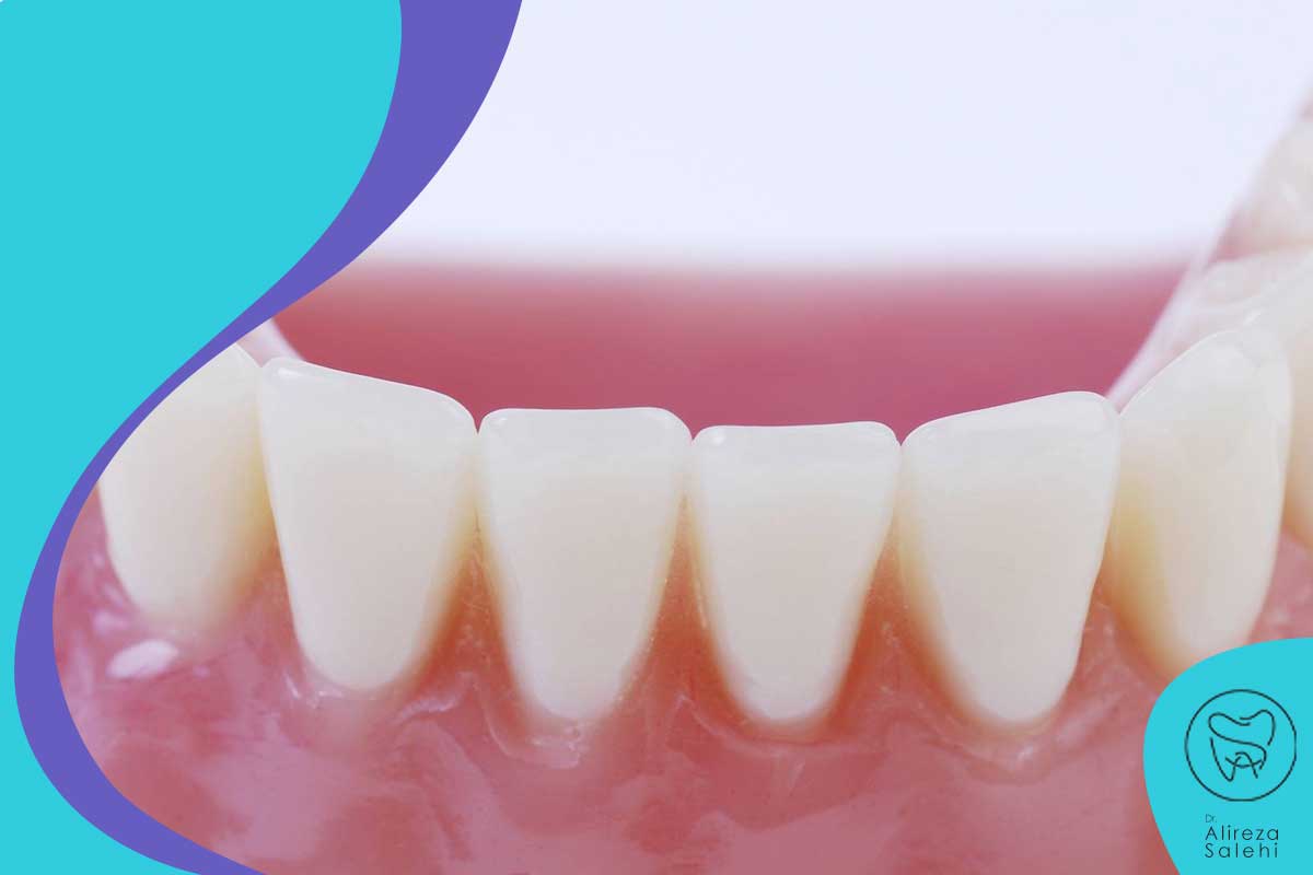 چگونه از فرسایش دندان جلوگیری می کنید؟
