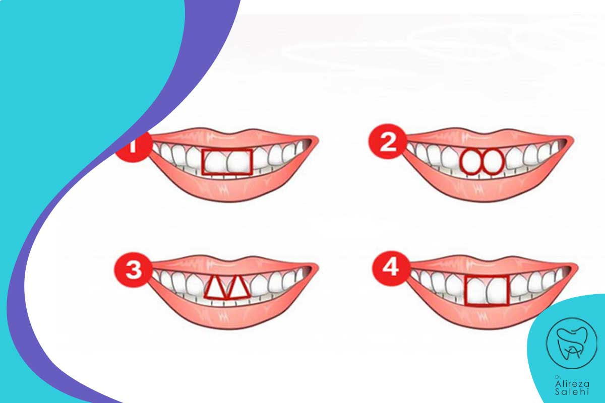 شخصیت دندان های مثلثی شکل