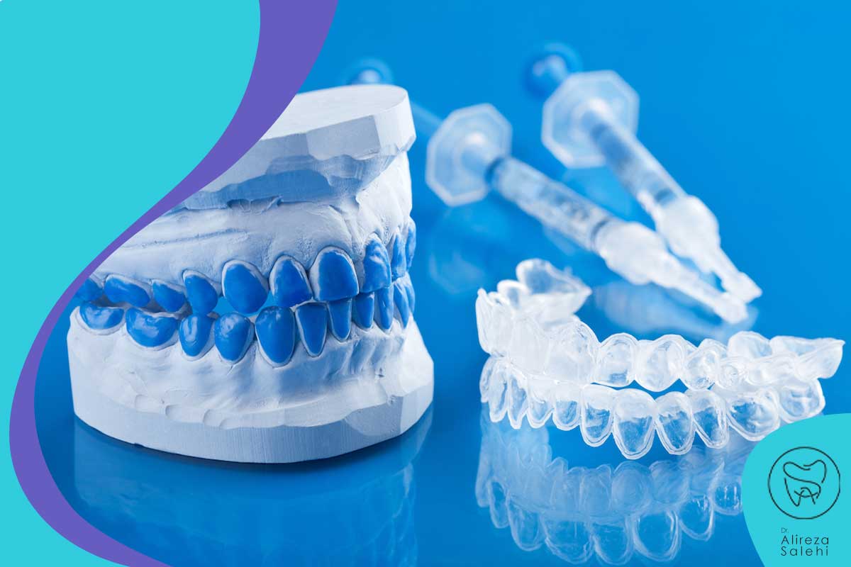 گزینه‌های بلیچینگ دندان در زعفرانیه چیست؟