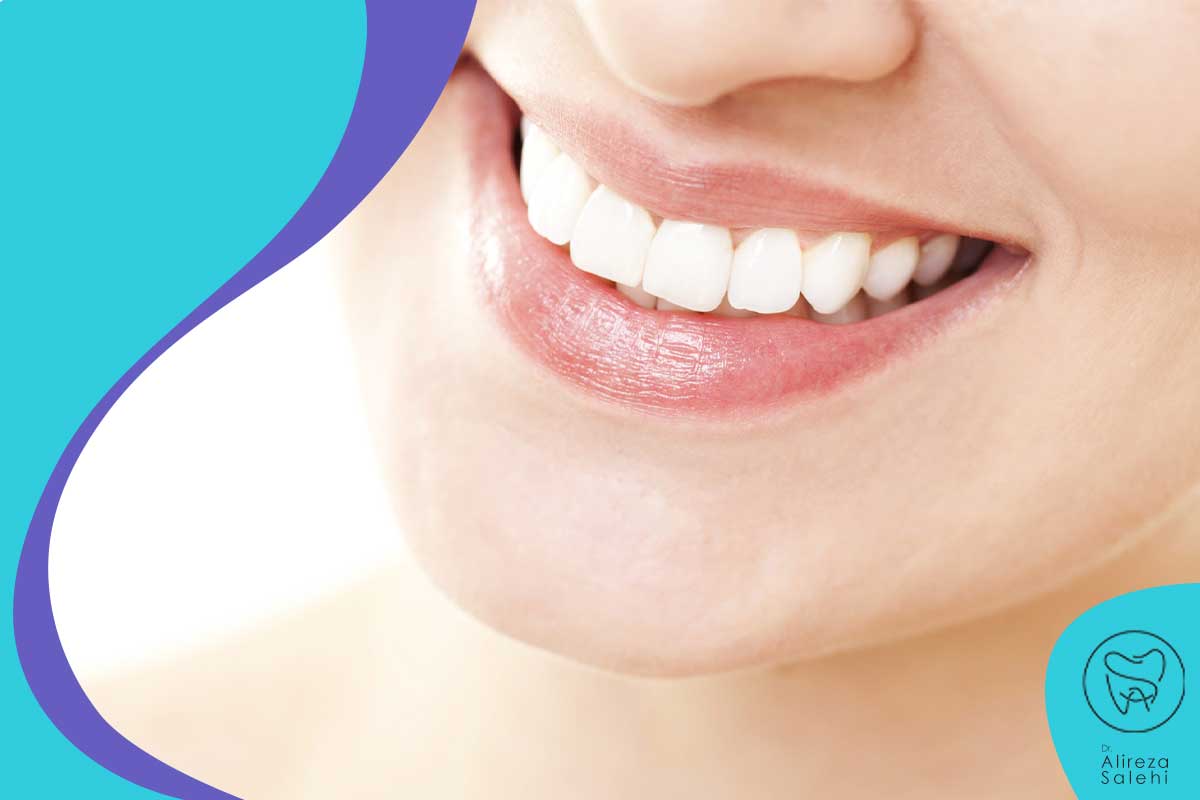 اهمیت سفید کردن دندان در مراقبت از دندان