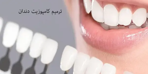 ترمیم کامپوزیت دندان