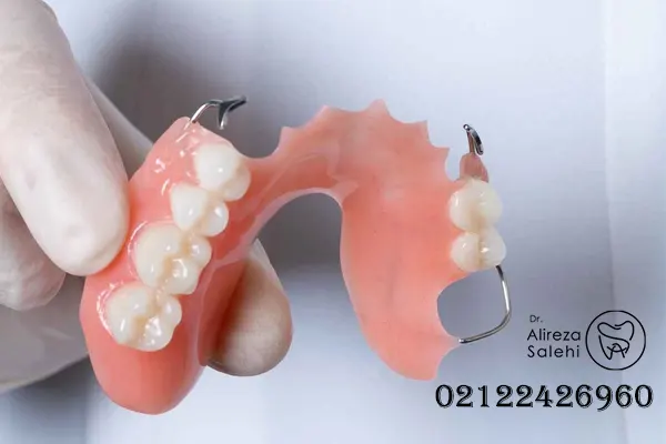 سن مناسب برای گذاشتن دندان مصنوعی