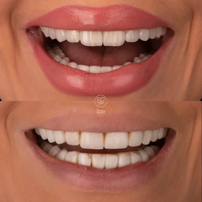 کار های دکتر علیرضا صالحی 80